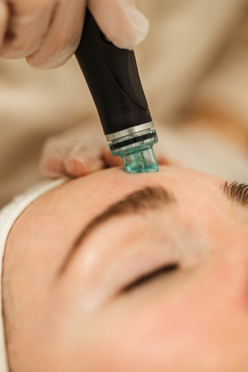 HydraFacial suction tool on skin